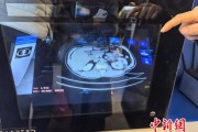 中新健康丨空中调阅患者资料，科幻！手术室也迎来“黑科技”