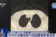 医学影像上“云”将给就医带来哪些改变？